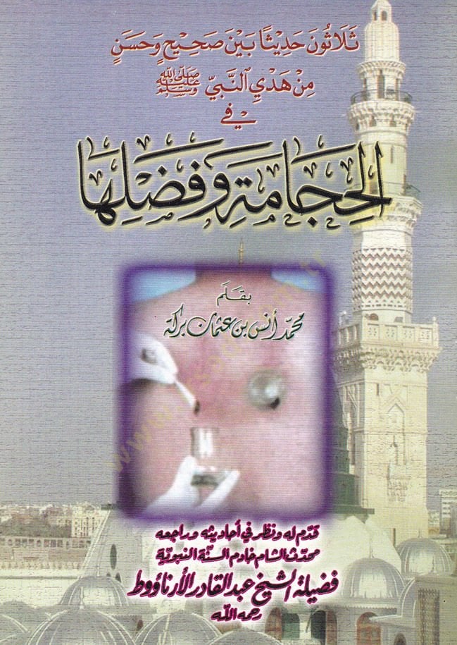Selasun Hadisen beyne Sahih ve Hasen min Hedyi En-Nebi (S.A.V.) fil-Hacame ve Fadlühu  - ثلاثون حديثا بين صحيح وحسن من هدي النبي صلى الله عليه وسلم في الحجامة وفضلها